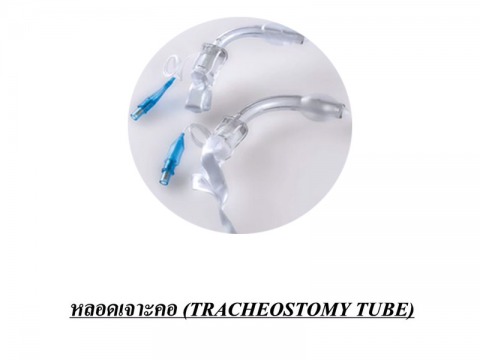 หลอดเจาะคอ